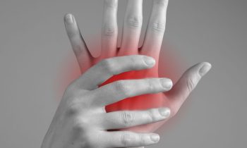 Carpal Tunnel Syndrome